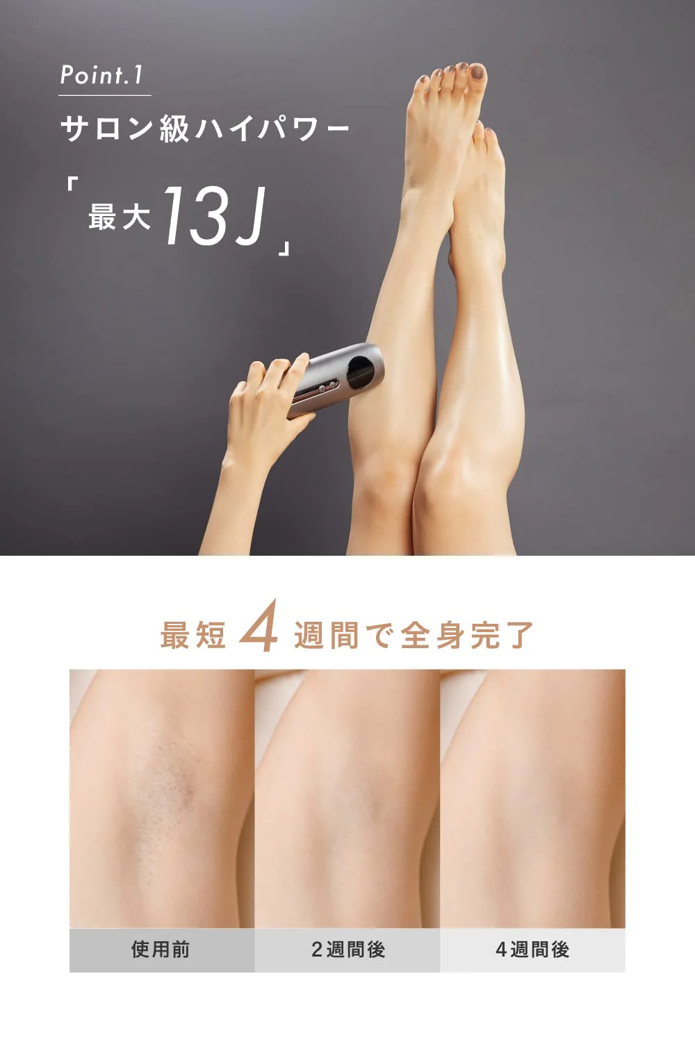 Noend VIO Compatible Cordless Hair Removal Device Double Cooling High Power AC100V-240V - Image 4